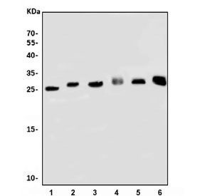 Western blot testing of 1) rat stomach, 2) rat kidney, 3) rat testis, 4) rat C6, 5) mouse kidney and 6) mouse NIH 3T3 cell lysate with Psmb1 antibody. Predicted molecular weight ~26 kDa.
