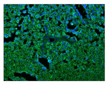Immunofluorescent staining of FFPE human tonsil tissue with CD45 antibody (green) and DAPI nuclear stain (blue). HIER: steam section in pH6 citrate buffer for 20 min.