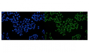 Immunofluorescent staining of FFPE human MCF7 cells with SRF antibody (green) and DAPI nuclear stain (blue). HIER: steam section in pH6 citrate buffer for 20 min.