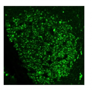 Ki-67 Antibody for IF Staining / Ki67 Staining Antibody (clone 5E12). Immunofluorescence analysis of FFPE human tonsil tissue using Ki-67 antibody for IF staining (clone 5E12). Strong nuclear fluorescence (green) is observed in numerous lymphoid cells within the germinal center region, consistent with the high proliferative activity typical of tonsillar lymphoid tissue. Ki-67 / MKI67 nuclear staining highlights actively cycling cells within the lymphoid follicle. Heat-induced epitope retrieval was performed by steaming tissue sections in pH6 citrate buffer for 20 minutes prior to immunofluorescence staining.
