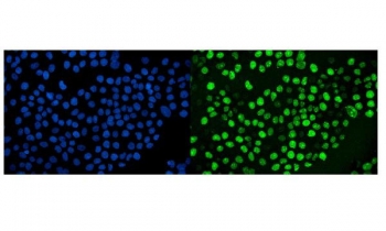Ki-67 Antibody for IF Staining / Ki67 Staining Antibody (clone 5E12). Immunofluorescence analysis of FFPE human A431 cells using Ki-67 antibody for IF staining (clone 5E12). Strong nuclear fluorescence (green) identifies proliferating cells expressing Ki-67 / MKI67, a nuclear marker associated with active phases of the cell cycle. Nuclei are counterstained with DAPI (blue), enabling visualization of total cell nuclei and facilitating comparison between Ki-67 positive proliferating cells and the broader cell population. Heat-induced epitope retrieval was performed by steaming sections in pH6 citrate buffer for 20 minutes prior to staining.