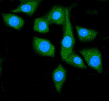 HSP90AA1 Antibody IF. Immunofluorescent staining of FFPE human SiHa cells using HSP90AA1 Antibody / Molecular Chaperone Antibody demonstrates strong cytoplasmic green fluorescence with minimal nuclear staining. The staining pattern is consistent with expression of HSP90AA1 (HSP90a), a highly conserved ATP-dependent molecular chaperone that regulates protein folding, stabilization of client proteins, signal transduction, and cellular stress-response pathways. HSP90AA1 is one of the most abundant intracellular chaperones and plays a central role in maintaining proteostasis and cellular homeostasis. HIER was performed by steaming sections in pH 6 citrate buffer for 20 minutes prior to staining. HSP90AA1 was detected with a green fluorophore, while nuclei were counterstained with DAPI (blue).