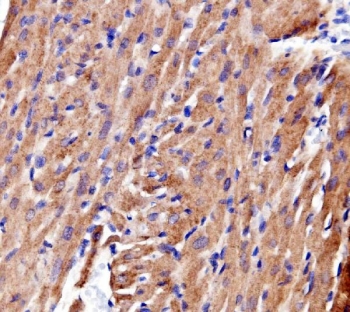 IHC staining of FFPE rat heart tissue with ACTN2 antibody. HIER: boil tissue sections in pH8 EDTA for 20 min and allow to cool before testing.