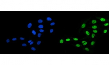 Immunofluorescent staining of FFPE human U-2 OS cells with CCAR2 antibody (green) and DAPI nuclear stain (blue). HIER: steam section in pH6 citrate buffer for 20 min.