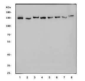 Western blot testing of 1) human Jurkat, 2) monkey COS-7, 3) human RT4, 4) human K562, 5) human HEL, 6) rat brain, 7) mouse brain and 8) mouse NIH 3T3 cell lysate with CCAR2 antibody. Expected molecular weight: 103-140 kDa depending on level of acetylation.
