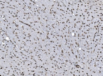IHC staining of FFPE rat brain tissue with CCAR2 antibody. HIER: boil tissue sections in pH8 EDTA for 20 min and allow to cool before testing.