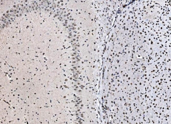 IHC staining of FFPE rat brain tissue with CCAR2 antibody. HIER: boil tissue sections in pH8 EDTA for 20 min and allow to cool before testing.