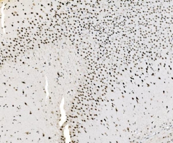 IHC staining of FFPE rat brain tissue with JUNB antibody. HIER: boil tissue sections in pH8 EDTA for 20 min and allow to cool before testing.
