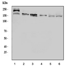 Western blot testing of 1) human RT4, 2) human HEL, 3) human HL60, 4) human ThP-1, 5) rat liver and 6) mouse liver lysate with ASK1 antibody. Predicted molecular weight ~155 kDa.