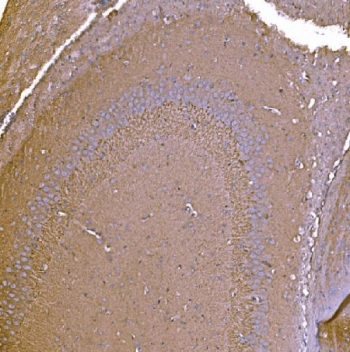 IHC staining of FFPE rat brain tissue with P2X7 antibody. HIER: boil tissue sections in pH8 EDTA for 20 min and allow to cool before testing.
