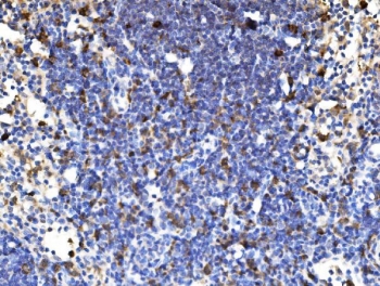 IHC staining of FFPE rat lymph node tissue with PAK1 antibody. HIER: boil tissue sections in pH8 EDTA for 20 min and allow to cool before testing.