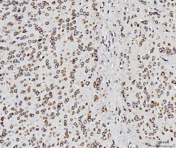 IHC staining of FFPE mouse brain tissue with RPL10 antibody. HIER: boil tissue sections in pH8 EDTA for 20 min and allow to cool before testing.