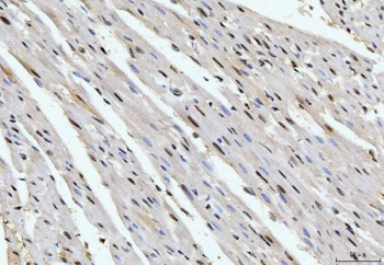 IHC staining of FFPE rat heart tissue with Cyclophilin E antibody. HIER: boil tissue sections in pH8 EDTA for 20 min and allow to cool before testing.