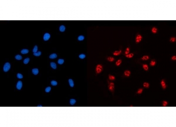 Immunofluorescent staining of FFPE human MCF7 cells with AKAP 95 antibody (red) and DAPI nuclear stain (blue). HIER: steam section in pH6 citrate buffer for 20 min.