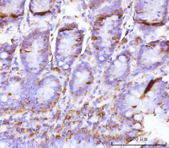 IHC staining of FFPE rat colon tissue with BZW2 antibody. HIER: boil tissue sections in pH8 EDTA for 20 min and allow to cool before testing.