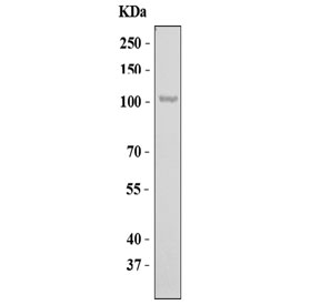 Western blot testing of human K562 cell lysate with EDEM3 antibody. Predicted molecular weight ~105 kDa.