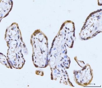 Immunohistochemistry of GHITM / MICS1 in human placental tissue. Formalin-fixed, paraffin-embedded human placental tissue stained with GHITM antibody shows cytoplasmic staining in trophoblastic cells lining chorionic villi, with minimal signal in surrounding stromal components. Antigen retrieval was performed by boiling tissue sections in EDTA buffer, pH 8.0, for 20 minutes, followed by cooling prior to immunostaining.