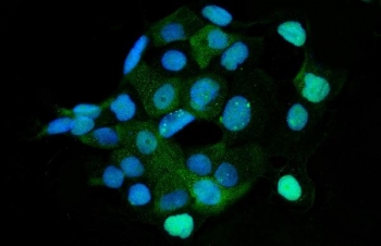 HMGCS1 Antibody A431 Cell IF. Immunofluorescent staining of FFPE human A431 cells using HMGCS1 Antibody / Mevalonate Pathway Enzyme Antibody demonstrates cytoplasmic green fluorescence throughout the cell population. The staining pattern is consistent with expression of HMGCS1, a cytosolic enzyme that catalyzes an early step in the mevalonate pathway responsible for cholesterol and isoprenoid biosynthesis. HMGCS1 localization within the cytoplasm reflects its role in cellular lipid metabolism, membrane biogenesis, and metabolic regulation. DAPI nuclear counterstain (blue) identifies cell nuclei and provides cellular context for HMGCS1 expression. HIER: steam section in pH6 citrate buffer for 20 min.