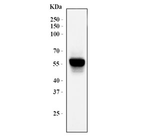 HMGCS1 Antibody HepG2 WB. Western blot analysis of human HepG2 cell lysate using HMGCS1 Antibody / Mevalonate Pathway Enzyme Antibody. A strong immunoreactive band is detected at approximately 57 kDa, consistent with the expected molecular weight of HMGCS1 (3-Hydroxy-3-Methylglutaryl-CoA Synthase 1). HMGCS1 is a key cytosolic enzyme of the mevalonate pathway that catalyzes the synthesis of HMG-CoA, an essential precursor for cholesterol and isoprenoid biosynthesis. The prominent single-band staining pattern supports specific detection of endogenous HMGCS1 and demonstrates the utility of this antibody for western blot applications. Predicted molecular weight: ~57 kDa. Observed molecular weight: ~57 kDa.