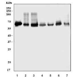 Western blot testing of 1) human HepG2, 2) human Caco-2, 3) human RT4, 4) rat liver, 5) rat RH35, 6) mouse liver and 7) mouse HEPA1-6 cell lysate with LSR antibody. Predicted molecular weight: 54-71 kDa (multiple isoforms).
