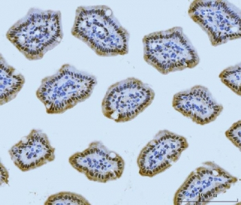 IHC staining of FFPE mouse colon tissue with Meiotic recombination 11 antibody. HIER: boil tissue sections in pH8 EDTA for 20 min and allow to cool before testing.