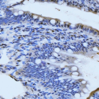 IHC staining of FFPE rat colon tissue with Meiotic recombination 11 antibody. HIER: boil tissue sections in pH8 EDTA for 20 min and allow to cool before testing.