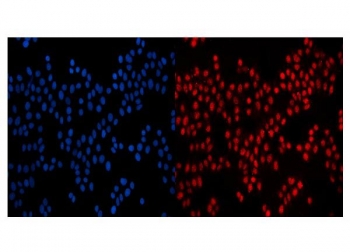 Immunofluorescent staining of FFPE human MCF7 cells with NUP210 antibody (red) and DAPI nuclear stain (blue). HIER: steam section in pH6 citrate buffer for 20 min.