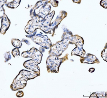 IHC staining of FFPE human placental tissue with Myomegalin antibody. HIER: boil tissue sections in pH8 EDTA for 20 min and allow to cool before testing.