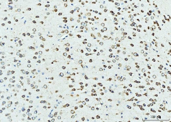 IHC staining of FFPE mouse brain tissue with RPL23 antibody. HIER: boil tissue sections in pH8 EDTA for 20 min and allow to cool before testing.