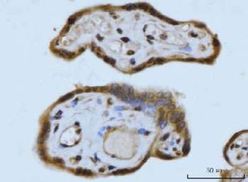 IHC staining of FFPE human placental tissue with Synaptonemal Complex Protein 3 antibody. HIER: boil tissue sections in pH8 EDTA for 20 min and allow to cool before testing.
