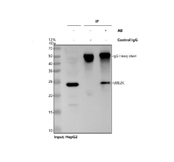 Immunoprecipitation of Huntingtin interacting protein 2 protein from 500ug of human HepG2 whole cell lysate with 2ug of Huntingtin interacting protein 2 antibody.