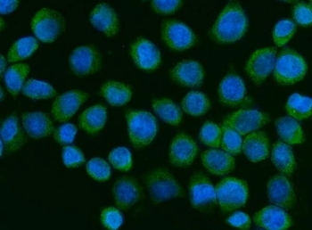 ZC3H7A Antibody SiHa IF. Immunofluorescence analysis of FFPE human SiHa cells using ZC3H7A Antibody / Zinc Finger CCCH-Type Containing 7A Antibody demonstrates diffuse green fluorescence distributed throughout the cytoplasm and extending into the perinuclear region, consistent with the reported localization of Zinc finger CCCH-type containing 7A (ZC3H7A), an RNA-binding protein involved in RNA metabolism and post-transcriptional regulation of gene expression. The staining pattern supports the association of ZC3H7A with intracellular RNA regulatory pathways and ribonucleoprotein complexes that govern transcript processing and cellular gene expression. Nuclei are visualized with DAPI nuclear stain (blue). HIER: steam tissue sections in pH6 citrate buffer for 20 minutes prior to staining. ZC3H7A antibody is shown in green and DAPI is shown in blue.