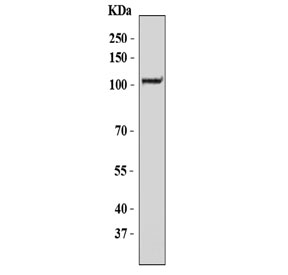 ZC3H7A Antibody K562 WB. Western blot analysis of human K562 cell lysate using ZC3H7A Antibody / Zinc Finger CCCH-Type Containing 7A Antibody detects a prominent band at approximately 110-115 kDa, consistent with the predicted molecular weight of Zinc finger CCCH-type containing 7A (ZC3H7A). ZC3H7A is a CCCH-type zinc finger RNA-binding protein that participates in RNA metabolism, messenger RNA processing, and post-transcriptional regulation of gene expression through interactions with RNA-containing protein complexes. The observed band is consistent with expression of full-length ZC3H7A in human K562 cells and supports the use of this antibody for studies of RNA-binding protein biology, transcript regulation, and cellular gene expression pathways. Predicted molecular weight: approximately 111 kDa.