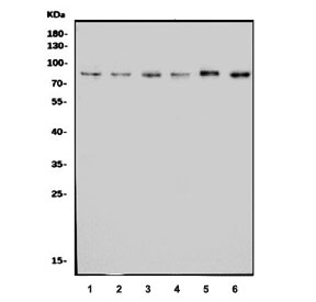 Western blot testing of human 1) HeLa, 2) Jurkat, 3) A431, 4) HEK293, 5) MCF7 and 6) PC-3 cell lysate with CENPB antibody. Expected molecular weight: 65-80 kDa.