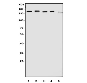 Western blot testing of 1) human K562, 2) human Raji, 3) human HeLa, 4) monkey COS-7 and 5) human Caco-2 cell lysate with Diaphanous Homolog 1 antibody. Predicted molecular weight ~140 kDa.