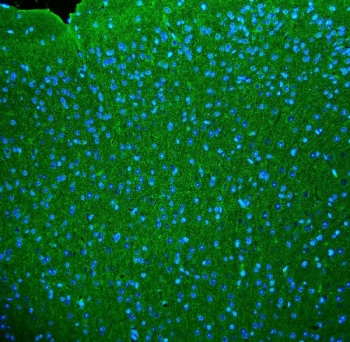 Synaptophysin Antibody for IF. Immunofluorescence staining of FFPE mouse brain tissue demonstrates strong punctate cytoplasmic labeling consistent with presynaptic vesicle localization of Synaptophysin (SYP). Fluorescent signal highlights synaptic vesicle clusters distributed throughout neuronal neuropil, while DAPI counterstain (blue) marks cell nuclei. Staining pattern reflects the dense synaptic network present in brain tissue. The Synaptophysin antibody (green) was used to visualize synaptic vesicle protein distribution in neuronal cells by immunofluorescence microscopy. Heat-induced epitope retrieval was performed by boiling sections in pH8 EDTA buffer for 20 minutes followed by cooling prior to staining.