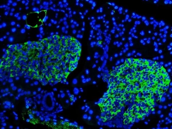 Synaptophysin Antibody for IF. Immunofluorescence staining of FFPE mouse pancreas tissue shows strong cytoplasmic fluorescence in pancreatic islet cells consistent with Synaptophysin (SYP) expression in neuroendocrine cells. Signal appears concentrated within the islets of Langerhans, while surrounding exocrine pancreatic tissue shows minimal staining. DAPI counterstain (blue) marks cell nuclei throughout the tissue section. The Synaptophysin antibody (green) was used to visualize neuroendocrine vesicle protein distribution in pancreatic endocrine cells by immunofluorescence microscopy. Heat-induced epitope retrieval was performed by boiling sections in pH8 EDTA buffer for 20 minutes followed by cooling prior to staining.