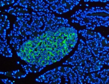 Synaptophysin Antibody for IF. Immunofluorescence staining of FFPE rat pancreas tissue shows strong cytoplasmic fluorescence localized to pancreatic islet cells, consistent with Synaptophysin (SYP) expression in neuroendocrine secretory vesicles. Fluorescent signal highlights endocrine cells within the islets of Langerhans, while surrounding exocrine pancreatic tissue shows minimal staining. DAPI counterstain (blue) marks nuclei throughout the tissue section. The Synaptophysin antibody (green) was used to visualize neuroendocrine vesicle protein distribution in pancreatic endocrine cells by immunofluorescence microscopy. Heat-induced epitope retrieval was performed by boiling sections in pH8 EDTA buffer for 20 minutes followed by cooling prior to staining.