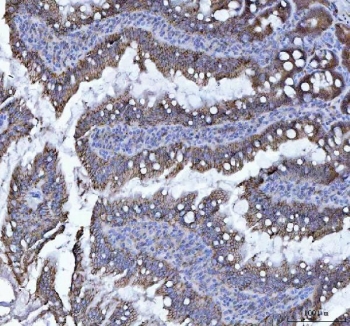 CDH17 Antibody Rat Colon IHC. Immunohistochemistry staining of FFPE rat colon tissue using CDH17 Antibody / Liver-Intestine Cadherin Antibody demonstrates distinct membranous HRP-DAB brown staining within colonic epithelial cells lining glandular and crypt structures. The staining pattern is consistent with expression of CDH17 (LI-cadherin), a calcium-dependent cell adhesion molecule involved in epithelial organization, maintenance of tissue integrity, and regulation of cell-cell interactions throughout the gastrointestinal tract. CDH17 is highly expressed in intestinal epithelial tissues and serves as a well-established marker of gastrointestinal epithelial differentiation and lineage. HIER was performed by boiling tissue sections in pH 8 EDTA buffer for 20 minutes followed by cooling prior to immunostaining.