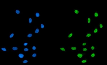 Immunofluorescent staining of FFPE human MCF7 cells with CPSF6 antibody (green) and DAPI nuclear stain (blue). HIER: steam section in pH6 citrate buffer for 20 min.