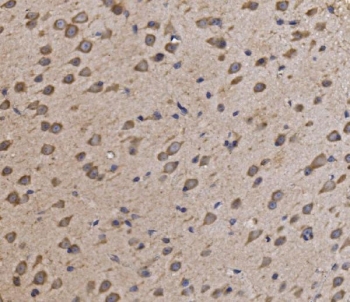 IHC staining of FFPE mouse brain tissue with NDUFAF1 antibody. HIER: boil tissue sections in pH8 EDTA for 20 min and allow to cool before testing.