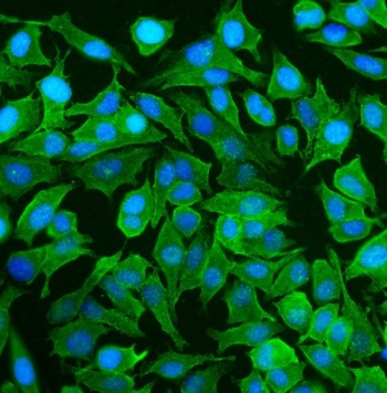 Immunofluorescence of NEAS antibody in human HeLa cells. FFPE HeLa cells show cytoplasmic green fluorescence consistent with SPTAN1 localization along the submembranous cytoskeleton and cellular extensions, while nuclei are counterstained with DAPI (blue). Heat-induced epitope retrieval was performed by steaming sections in pH 6 citrate buffer for 20 minutes prior to staining.
