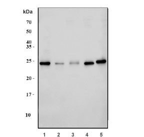 Western blot testing of 1) human K562, 2) rat lung, 3) rat stomach, 4) rat C6 and 5) mouse RAW264.7 cell lysate with TMED5 antibody. Expected molecular weight: 24-28 kDa.