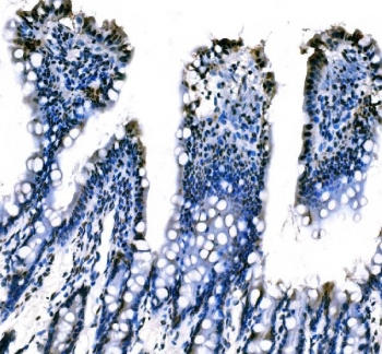 IHC staining of FFPE rat colon tissue with Splicing factor 1 antibody. HIER: boil tissue sections in pH8 EDTA for 20 min and allow to cool before testing.