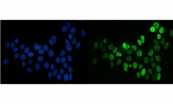 Immunofluorescent staining of FFPE human A431 cells with SF1 antibody (green) and DAPI nuclear stain (blue). HIER: steam section in pH6 citrate buffer for 20 min.