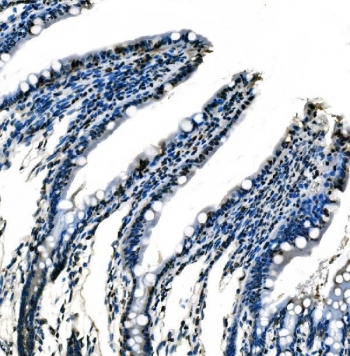 IHC staining of FFPE rat colon tissue with SF1 antibody. HIER: boil tissue sections in pH8 EDTA for 20 min and allow to cool before testing.
