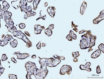 IHC staining of FFPE human placental tissue with Glutaminase antibody. HIER: boil tissue sections in pH8 EDTA for 20 min and allow to cool before testing.