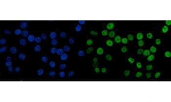Immunofluorescent staining of FFPE human Caco-2 cells with MCM6 antibody (green) and DAPI nuclear stain (blue). HIER: steam section in pH6 citrate buffer for 20 min.