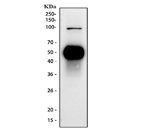 Western blot testing of human Jurkat cell lysate with CD2 antibody. Expected molecular weight ~47 kDa.