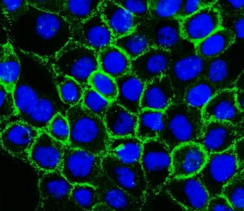 P-Cadherin Antibody A431 Cell IF. Immunofluorescence analysis of FFPE human A431 cells using P-Cadherin Antibody / Epithelial Cell Adhesion Antibody. Heat induced antigen retrieval was performed by steaming sections in pH 6 citrate buffer for 20 minutes. P-Cadherin expression is shown in green with DAPI nuclear counterstain shown in blue. Strong membrane-associated staining is observed at cell-cell junctions, supporting the use of P-Cadherin Antibody / Epithelial Cell Adhesion Antibody for studying epithelial adhesion proteins, adherens junction formation and cell communication pathways.